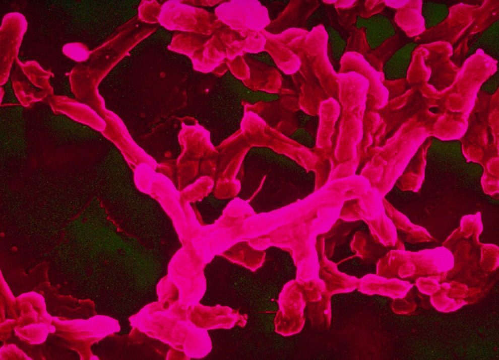 typhoid bacteria
